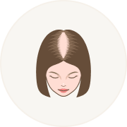 Female Hair Loss Pattern 1
