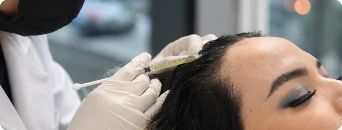 PRP Hair Treatment in padra clinic in dubai