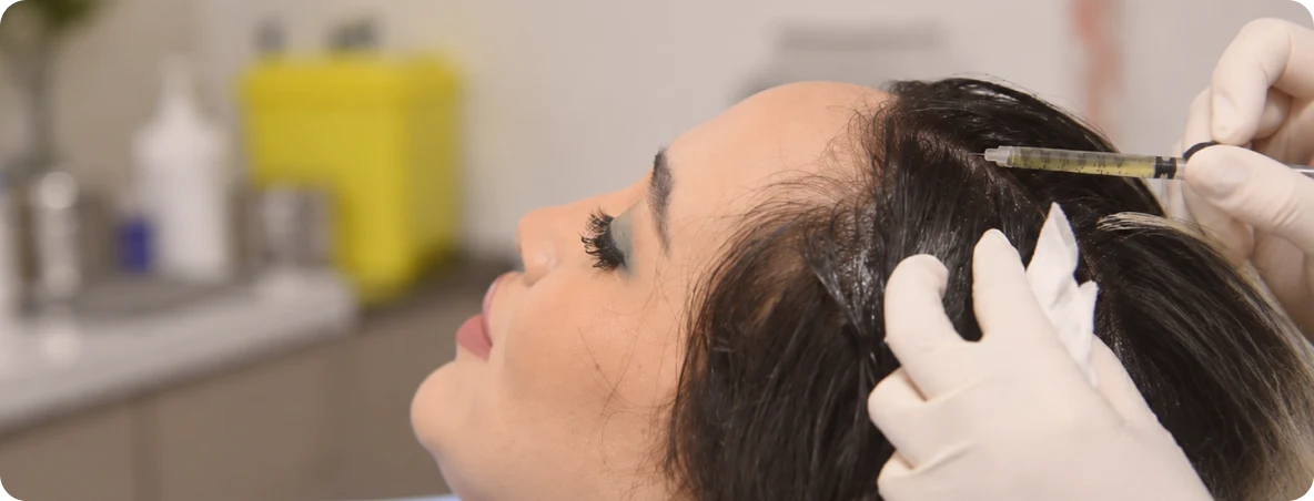 PRP Hair Treatment