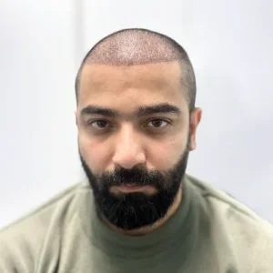 يوم الإجراء