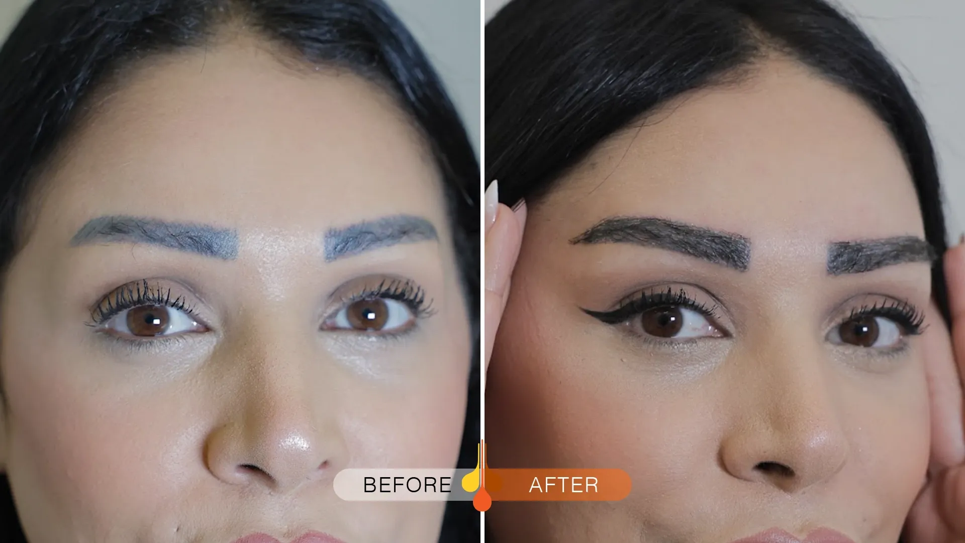 eyebrow-transplant-qatar-03