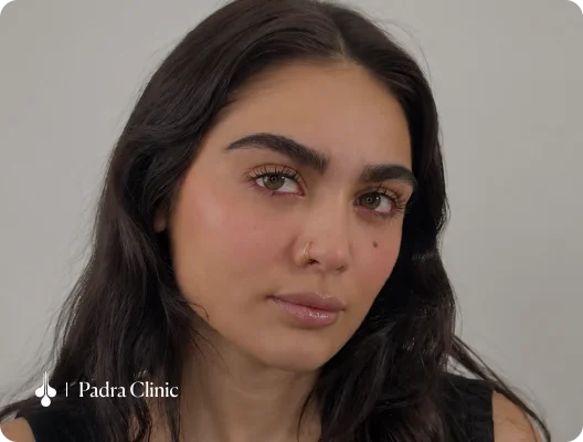 eyebrow-transplant-testimonial-02