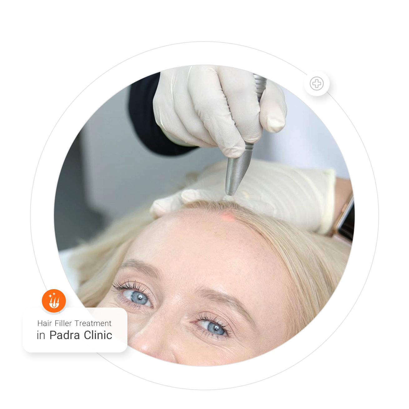 Hair Filler Treatment