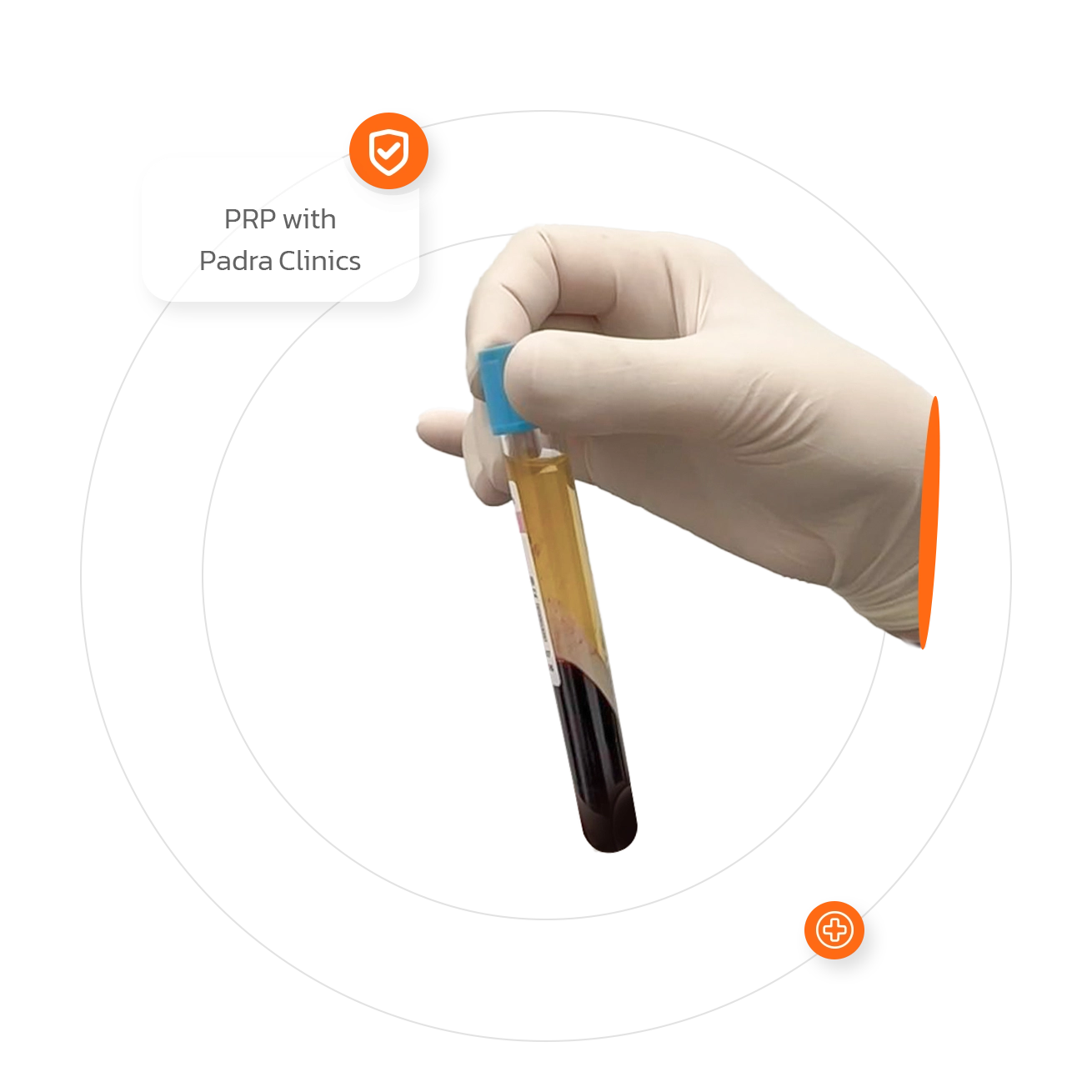 PRP hair restoration results in Riyadh