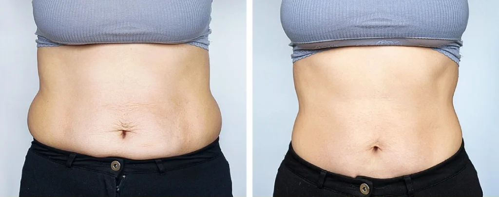 how to slim your waist