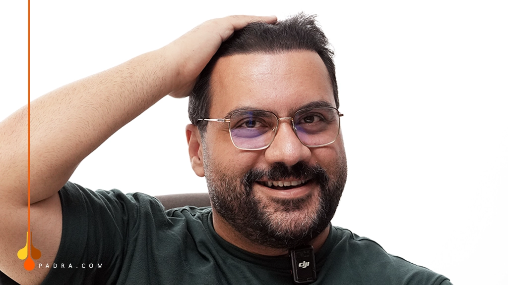 does hair transplant hurt?