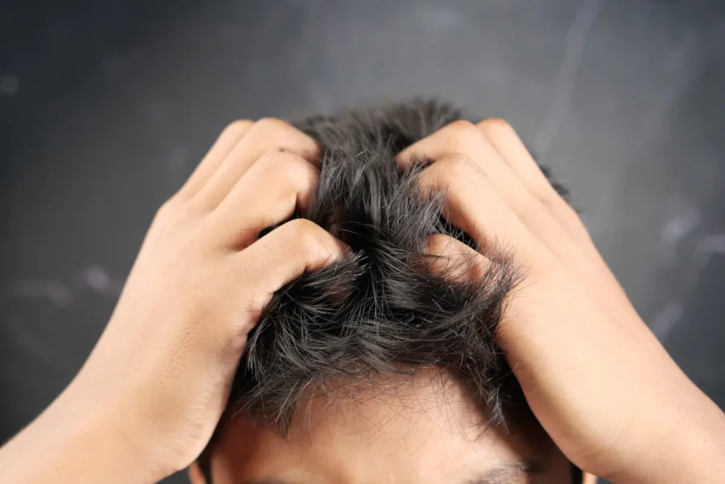 itchy after hair transplant