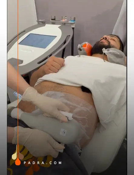 تجميد و تكسير الدهون بجهاز كريستال برو 