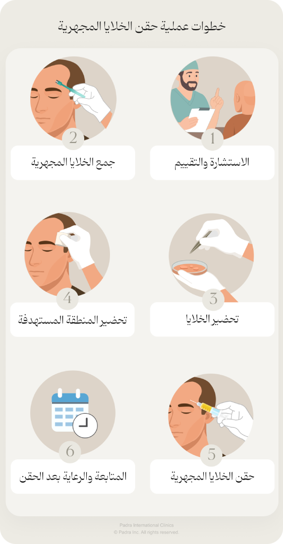خطوات حقن الخلايا المجهرية للشعر 