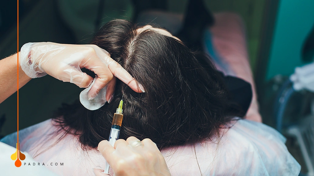 hair mesotherapy for hair restoration